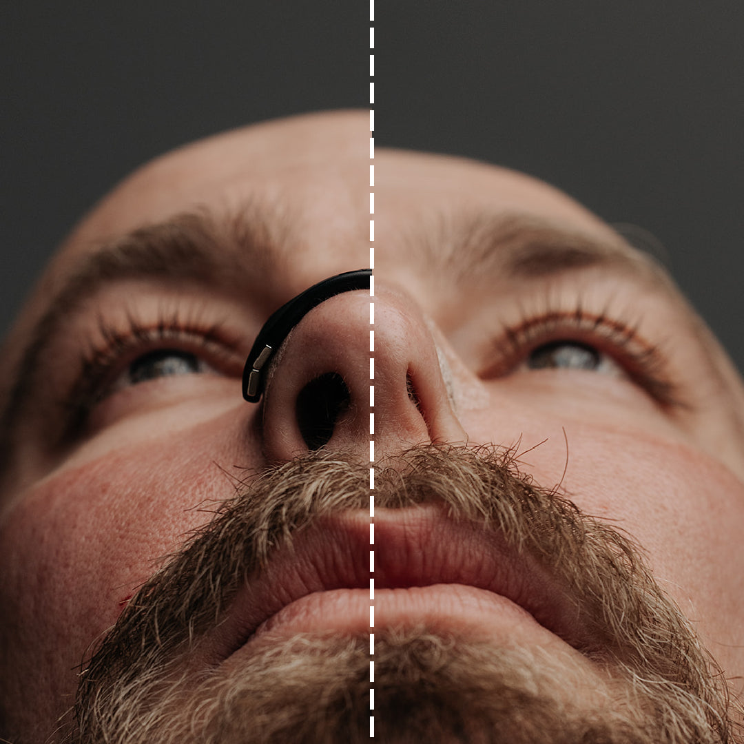 Cruvelo Nasal Strip